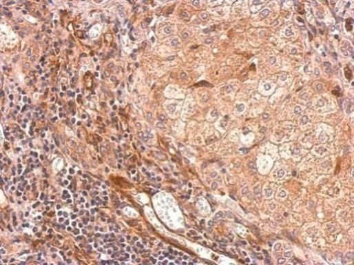 TIMP1 Antibody in Immunohistochemistry (Paraffin) (IHC (P))