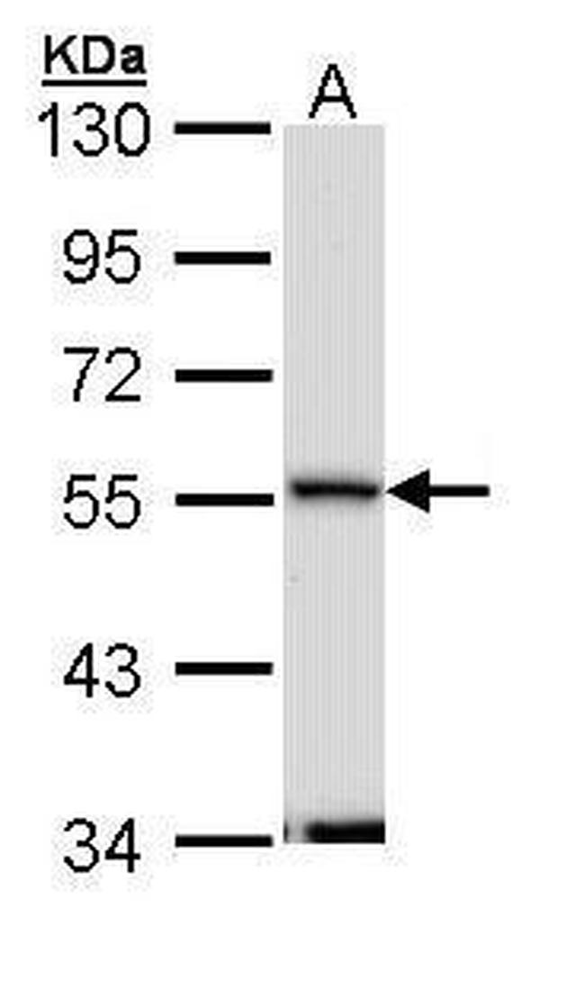 Septin-11 Antibody in Western Blot (WB)