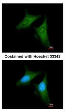 beta COP Antibody in Immunocytochemistry (ICC/IF)