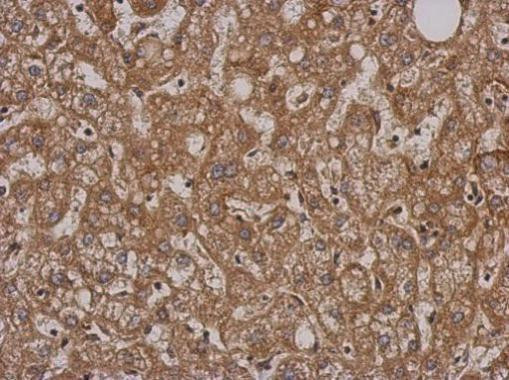SH2D3C Antibody in Immunohistochemistry (Paraffin) (IHC (P))