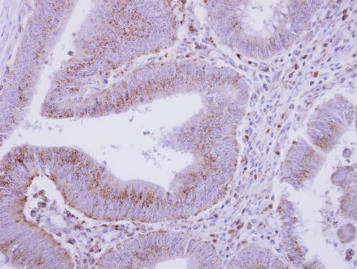 beta COP Antibody in Immunohistochemistry (Paraffin) (IHC (P))