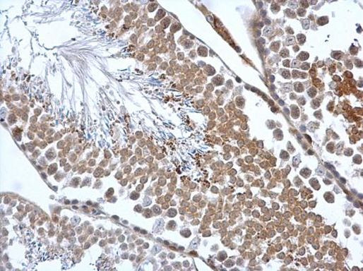 Calreticulin 3 Antibody in Immunohistochemistry (Paraffin) (IHC (P))