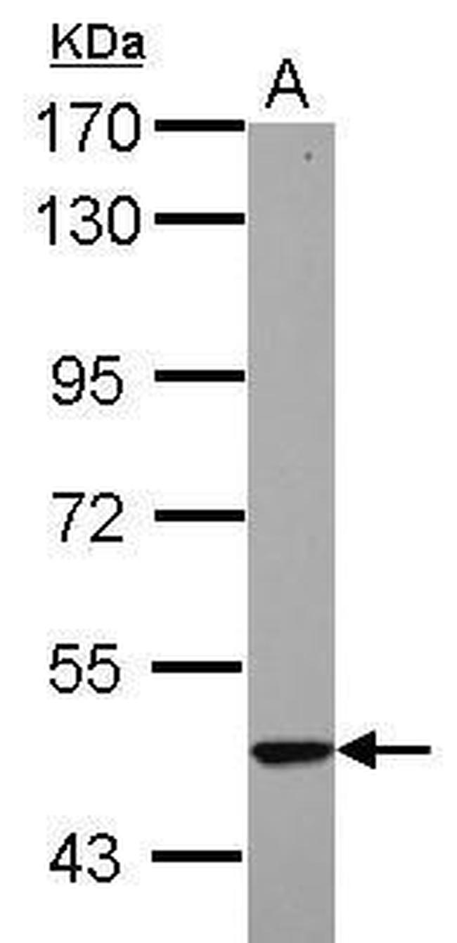 Cytokeratin 23 Antibody in Western Blot (WB)