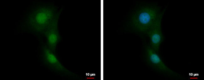 RNF14 Antibody in Immunocytochemistry (ICC/IF)
