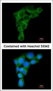 GGA2 Antibody in Immunocytochemistry (ICC/IF)