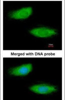 ECM29 Antibody in Immunocytochemistry (ICC/IF)