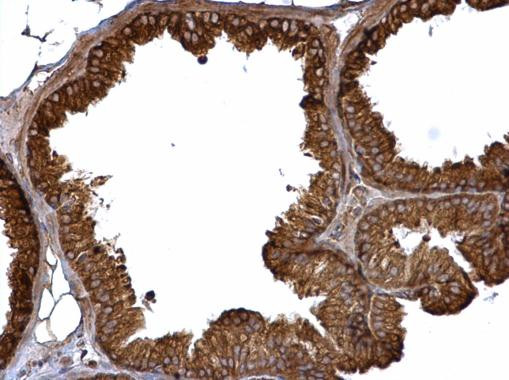 ASB2 Antibody in Immunohistochemistry (Paraffin) (IHC (P))