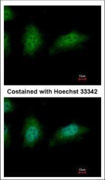 ZNHIT2 Antibody in Immunocytochemistry (ICC/IF)