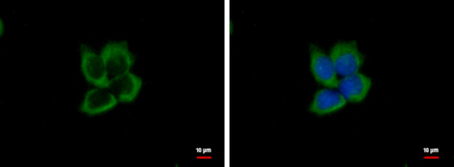 eIF3e Antibody in Immunocytochemistry (ICC/IF)