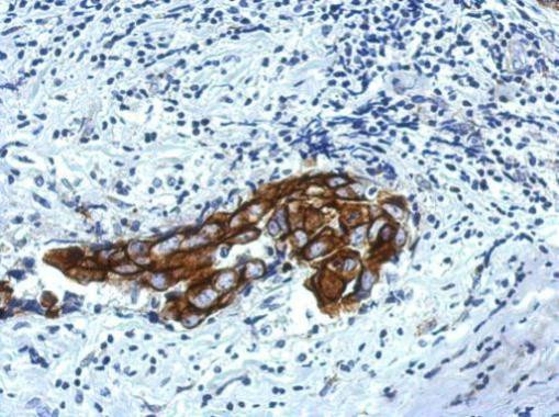 IPP Antibody in Immunohistochemistry (Paraffin) (IHC (P))