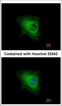 Cytokeratin 33B Antibody in Immunocytochemistry (ICC/IF)
