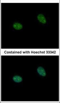 PRICKLE3 Antibody in Immunocytochemistry (ICC/IF)