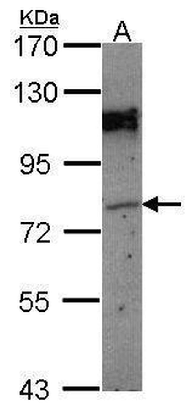 GPIP137 Antibody in Western Blot (WB)