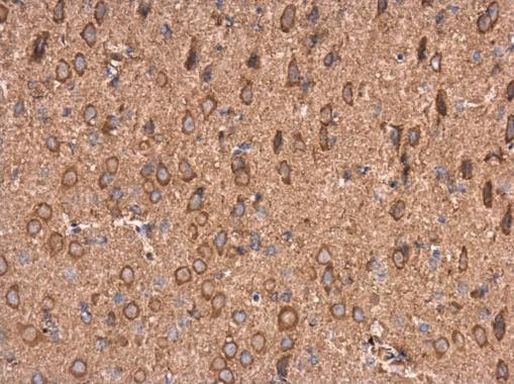 AMPD2 Antibody in Immunohistochemistry (Paraffin) (IHC (P))