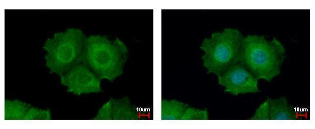 Cytokeratin 31 Antibody in Immunocytochemistry (ICC/IF)