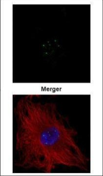 Coilin Antibody in Immunocytochemistry (ICC/IF)