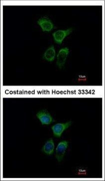 ERO1L Antibody in Immunocytochemistry (ICC/IF)