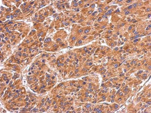 HSPA4 Antibody in Immunohistochemistry (Paraffin) (IHC (P))
