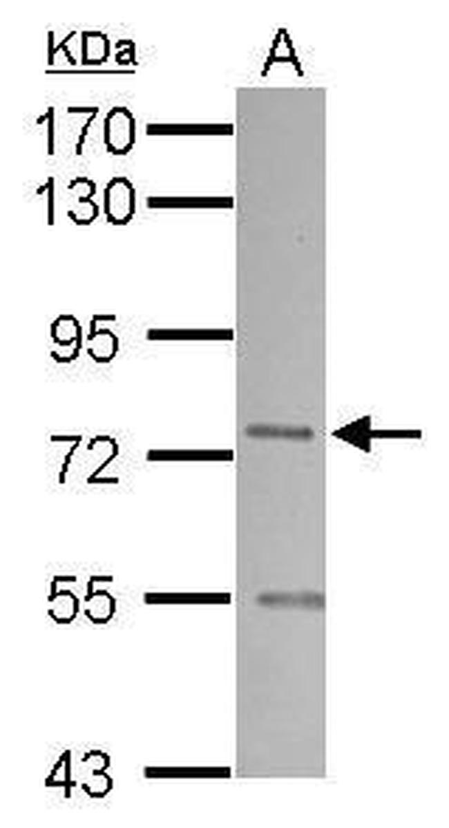 SNX1 Antibody in Western Blot (WB)