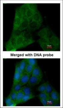 p23 Antibody in Immunocytochemistry (ICC/IF)