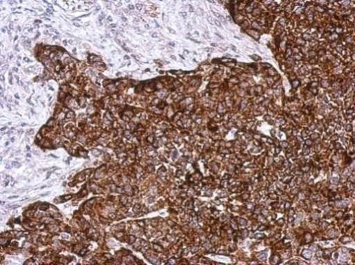 cathepsin A Antibody in Immunohistochemistry (Paraffin) (IHC (P))