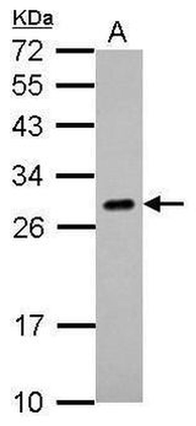 Endothelin 1 Antibody in Western Blot (WB)