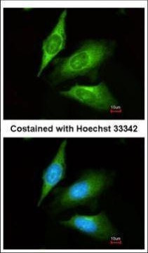 TMED4 Antibody in Immunocytochemistry (ICC/IF)