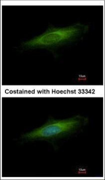 LAMP3 Antibody in Immunocytochemistry (ICC/IF)