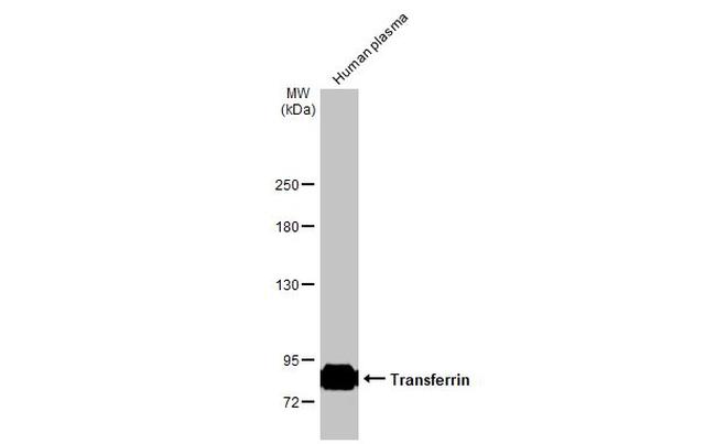 Transferrin Antibody in Western Blot (WB)