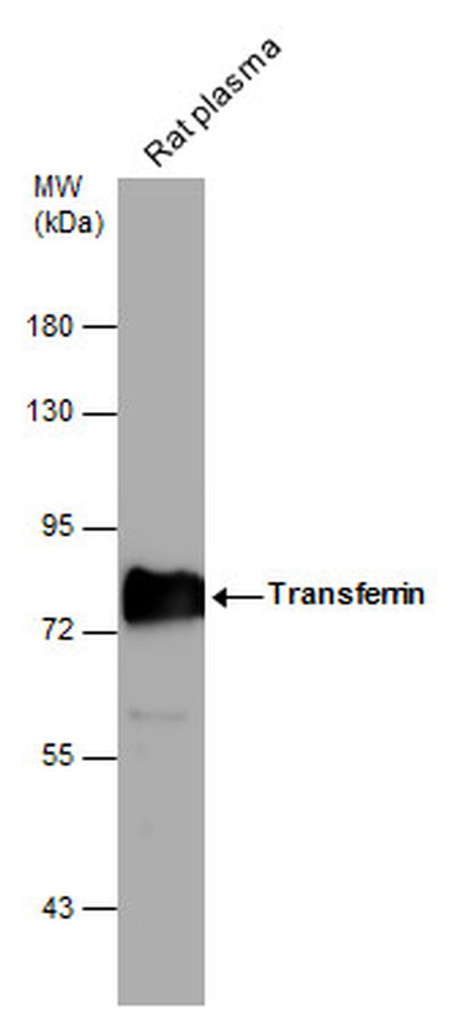 Transferrin Polyclonal Antibody (PA5-29568)
