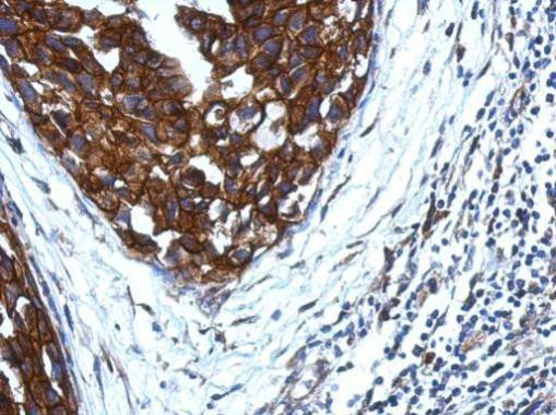 KIR2DS4 Antibody in Immunohistochemistry (Paraffin) (IHC (P))