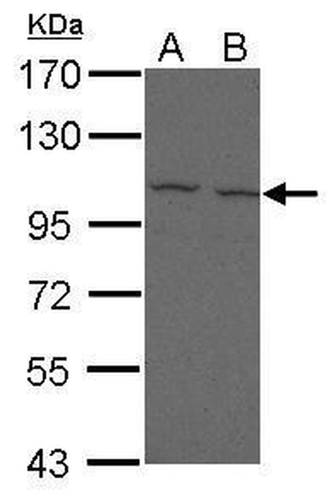CD307e (FcRL5) Antibody in Western Blot (WB)