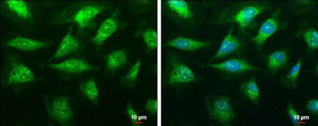 C1QA Antibody in Immunocytochemistry (ICC/IF)