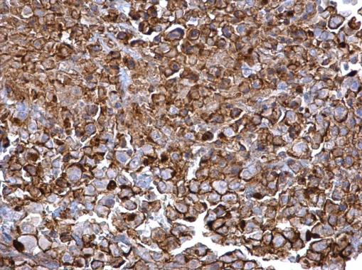 CD44 Antibody in Immunohistochemistry (Paraffin) (IHC (P))