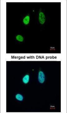 ERG Antibody in Immunocytochemistry (ICC/IF)