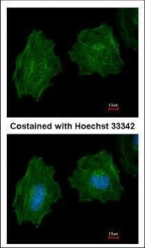 Filamin A alpha-2 Antibody in Immunocytochemistry (ICC/IF)