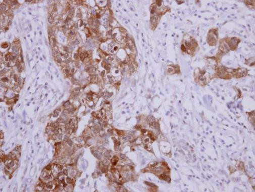 HSP70 Antibody in Immunohistochemistry (Paraffin) (IHC (P))