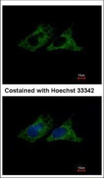 ITGB1 Antibody in Immunocytochemistry (ICC/IF)