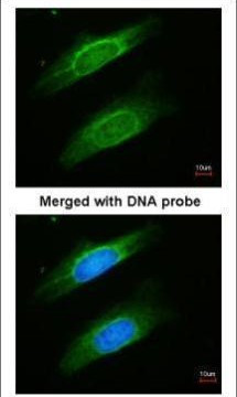 Cytokeratin 8 Antibody in Immunocytochemistry (ICC/IF)