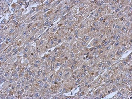 Cytokeratin 14 Antibody in Immunohistochemistry (Paraffin) (IHC (P))