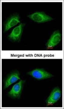 Cytokeratin 18 Antibody in Immunocytochemistry (ICC/IF)