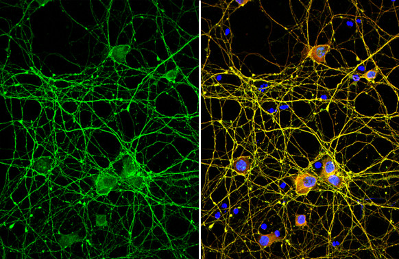 Tau Antibody in Immunocytochemistry (ICC/IF)