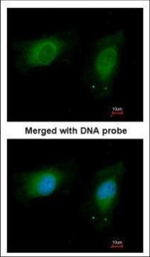 NME1 Antibody in Immunocytochemistry (ICC/IF)