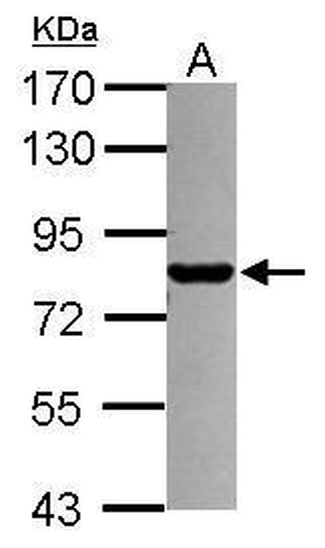 PML Antibody in Western Blot (WB)