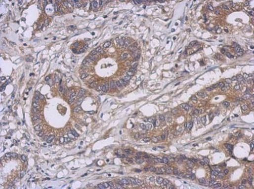 AMPK alpha-1 Antibody in Immunohistochemistry (Paraffin) (IHC (P))