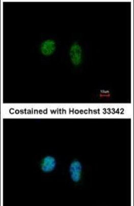 THRA Antibody in Immunocytochemistry (ICC/IF)