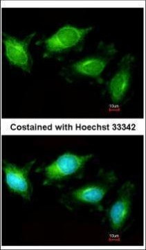 TLR3 Antibody in Immunocytochemistry (ICC/IF)