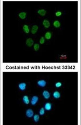 XPA Antibody in Immunocytochemistry (ICC/IF)