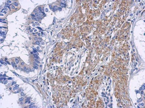 RIP2 Antibody in Immunohistochemistry (Paraffin) (IHC (P))
