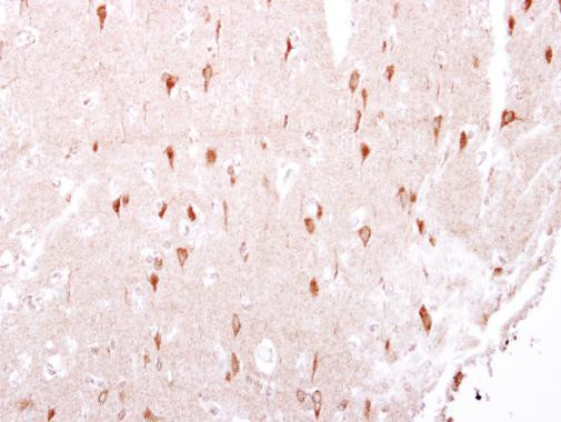 LRRK2 Antibody in Immunohistochemistry (Paraffin) (IHC (P))